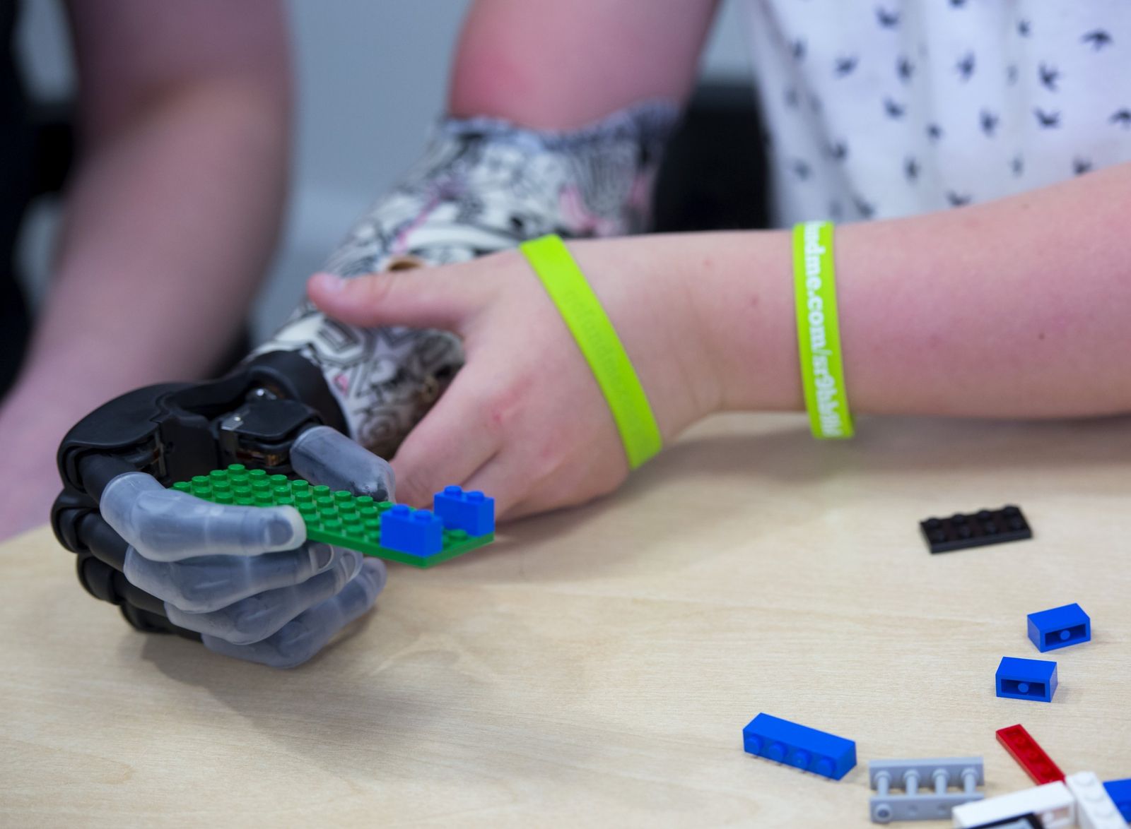 A Bionic Hand